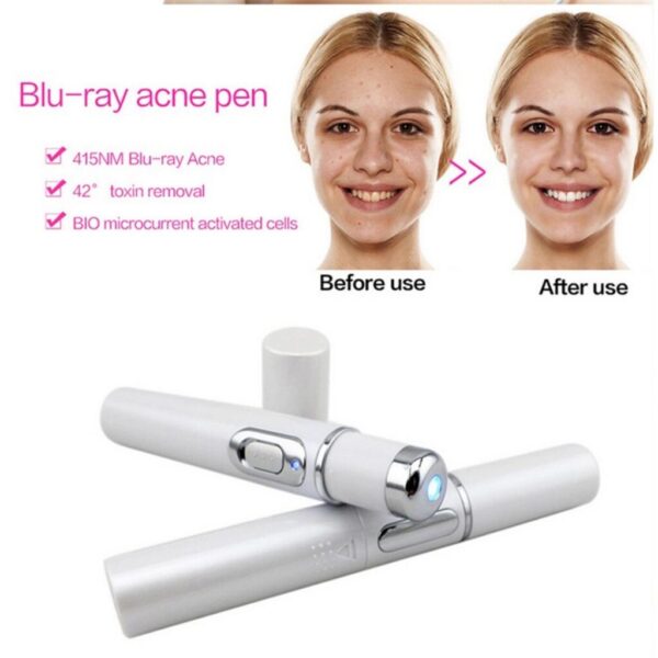 Blue Light Therapy Acne Laser Pen Soft Scar Wrinkle Removal - Image 9