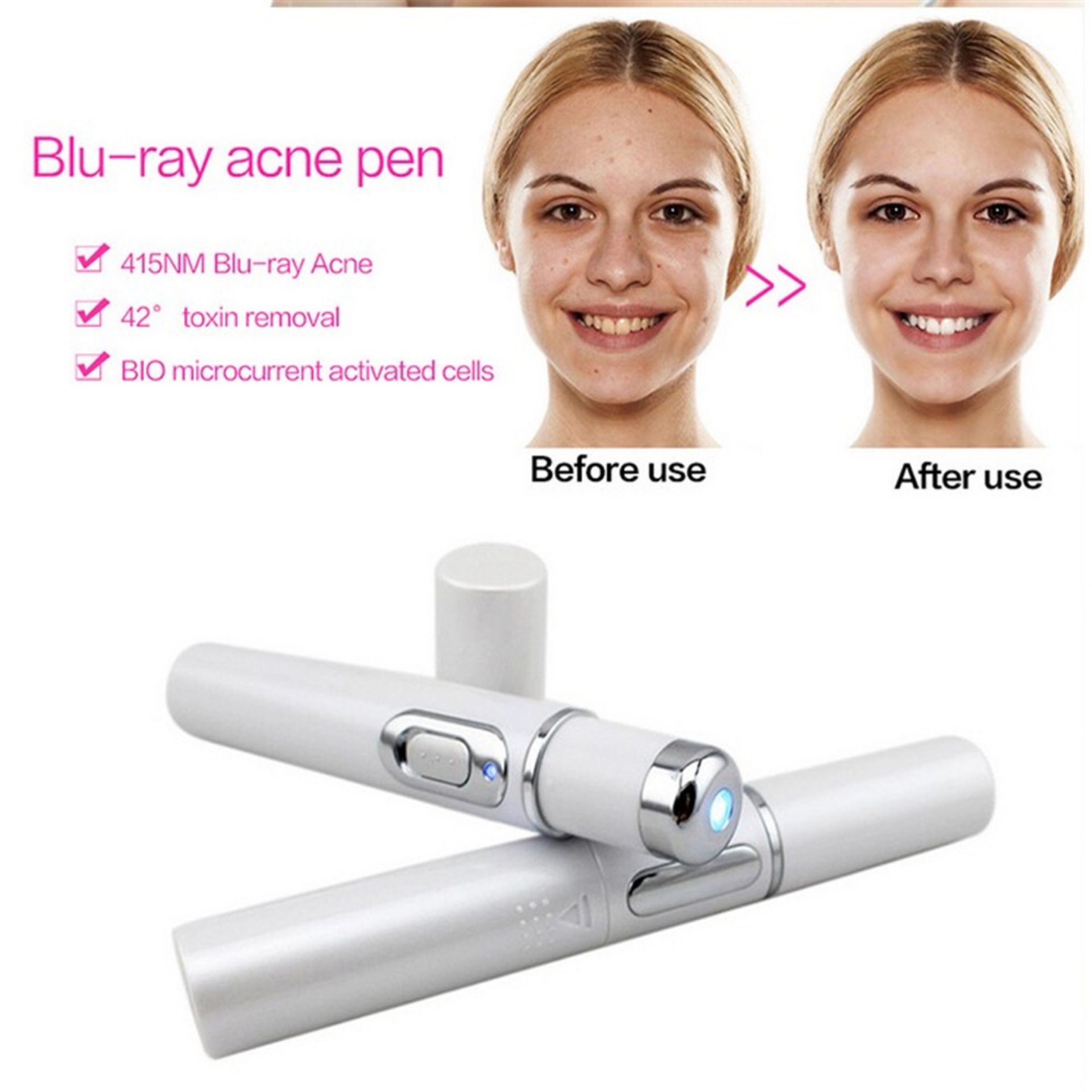 Blue Light Therapy Acne Laser Pen Soft Scar Wrinkle Removal - Image 9