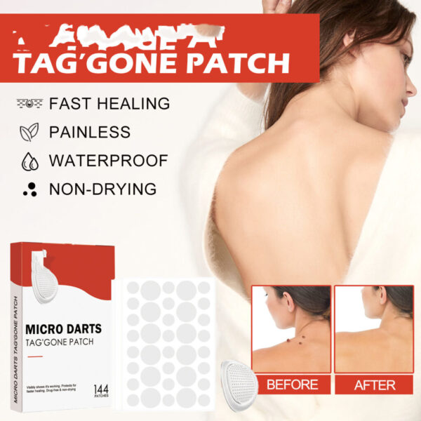 Acne Cleaning Fade Spots Acne Patch - Image 4