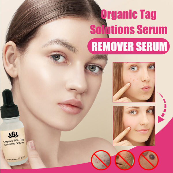 Organic Tags Solutions Serum No Trace Skin Tag Remover Serum