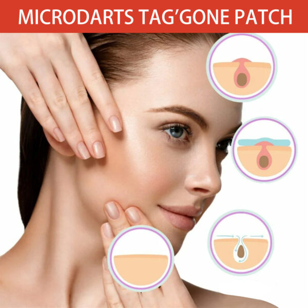 Skin Anti-acne Acne Black Mole Repair Skin Label - Image 3