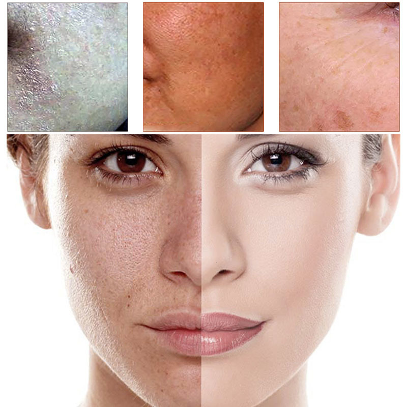 Hydrating Moisturizing After Sun Repair Hyaluronic Acid Serum - Image 2