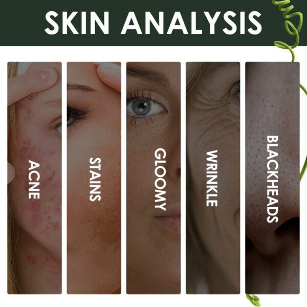 Acne Marks Blackhead Brightening Skin - Image 3