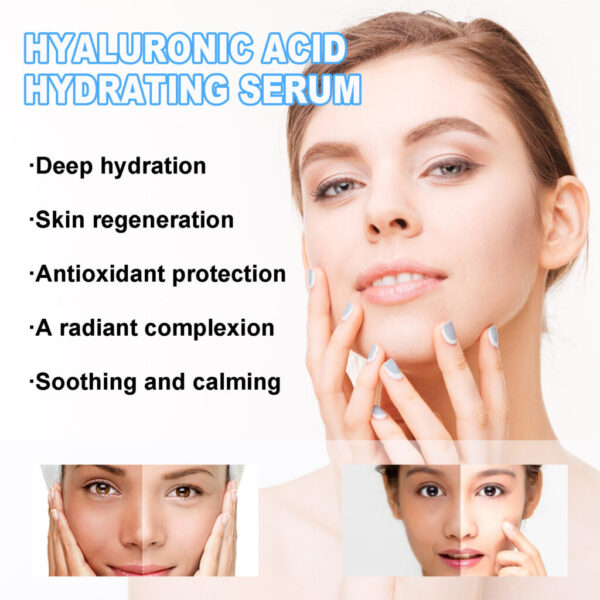 Hyaluronic Acid Skin Care Hydrating Anti-wrinkle Moisturizing Facial Skin - Image 5