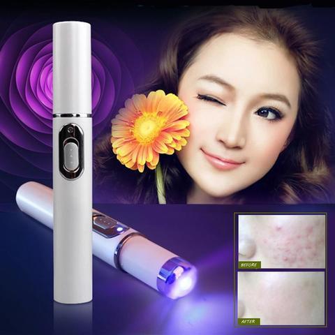 Blue Light Therapy Acne Laser Pen Soft Scar Wrinkle Removal - Image 2