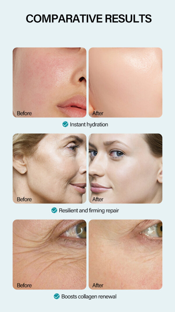 Anti-Wrinkle Face Cream Hyaluronic Acid - Image 6