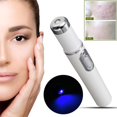Blue Light Therapy Acne Laser Pen Soft Scar Wrinkle Removal - Image 10
