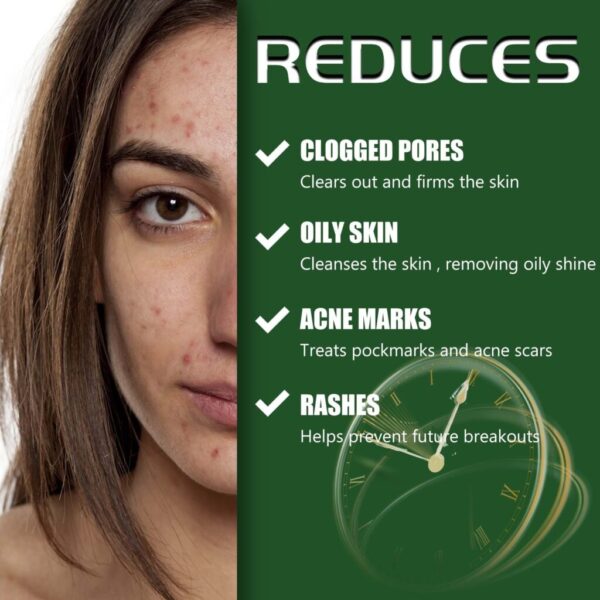 Cream Skin Repair Clean Acne Care - Image 4