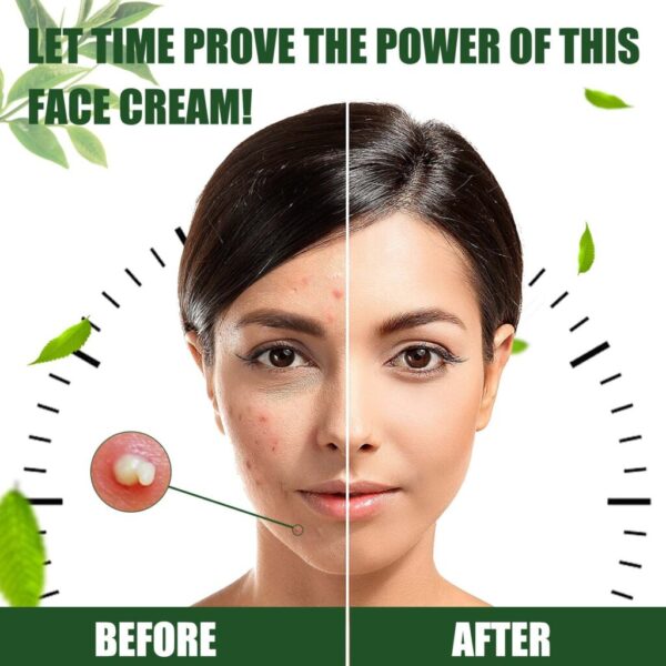 Cream Skin Repair Clean Acne Care - Image 3