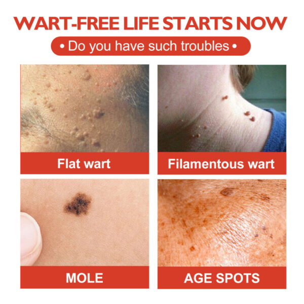 Acne Cleaning Fade Spots Acne Patch - Image 6