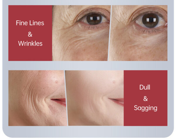 Brightening Skin Color Nourishing Moisturizing Skin Anti-aging Repair Cream - Image 10