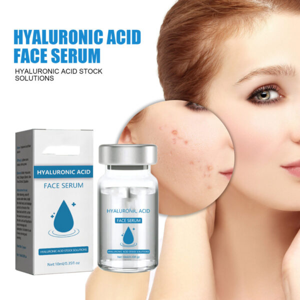 Hyaluronic Acid Replenishment - Image 9