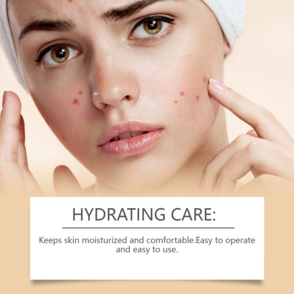 Acne Patch Gentle Cleansing And Skin Care - Image 4