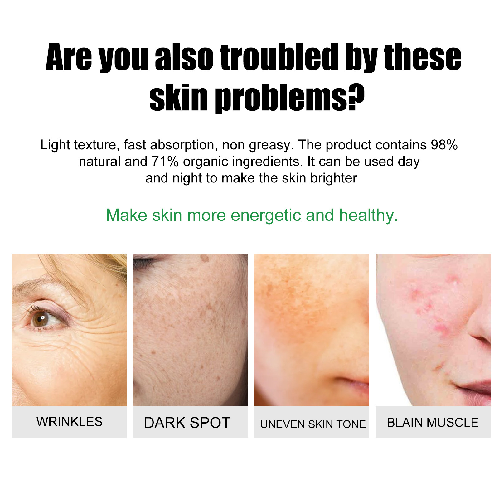 Blemish Cream Lightens Blemishes & Acne Brightens Skin Complexion - Image 5