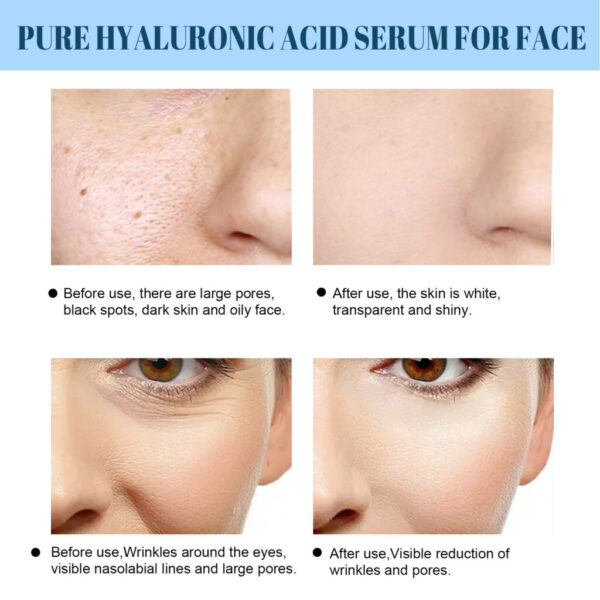 Hyaluronic Acid Liquid Facial Moisturizing - Image 4
