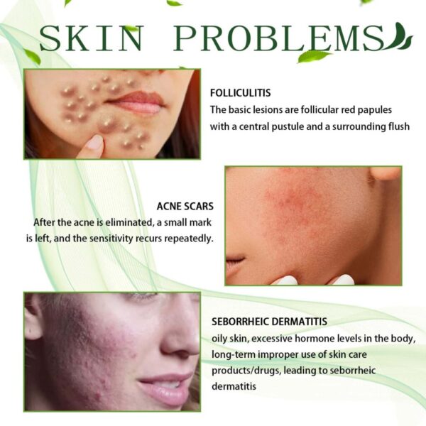 Cream Skin Repair Clean Acne Care - Image 5