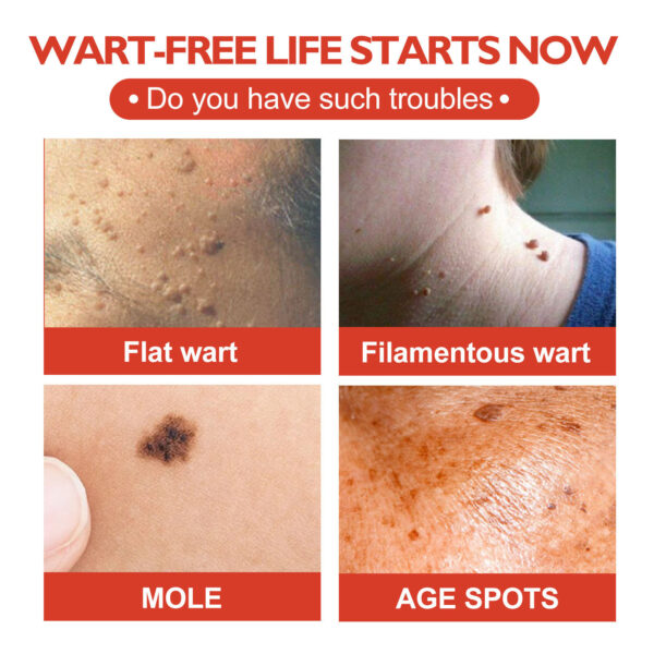 Skin Anti-acne Acne Black Mole Repair Skin Label - Image 2