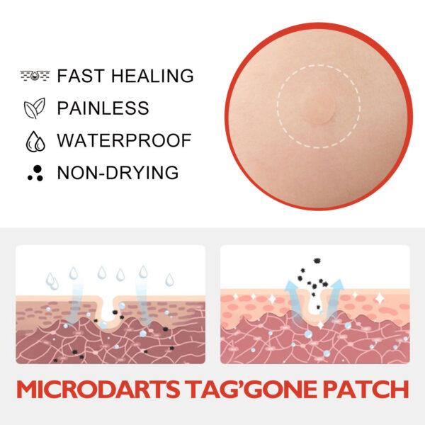 Skin Anti-acne Acne Black Mole Repair Skin Label - Image 4